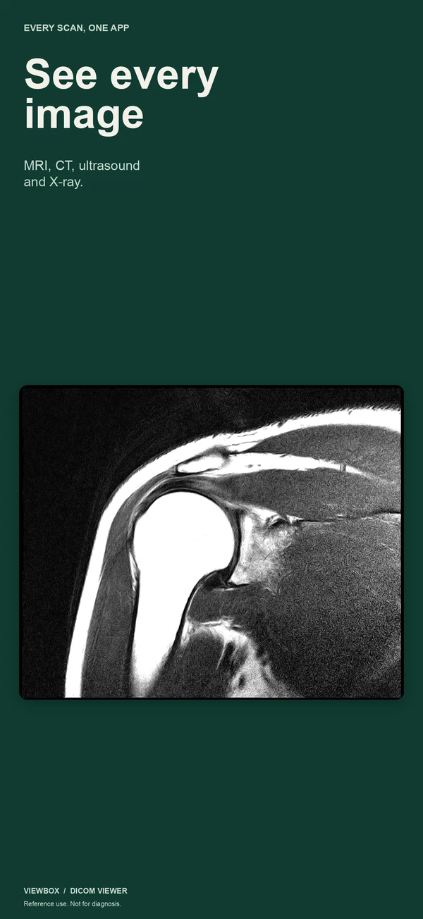 An MRI of a shoulder in the viewer with its window and level