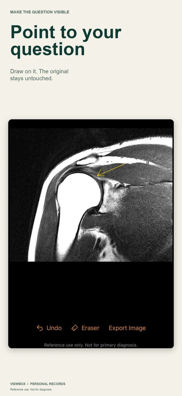 A drawn arrow on the MRI marking the spot to ask about